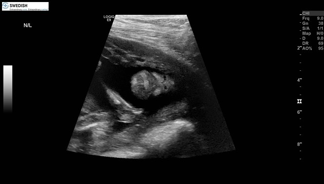 1.2.840.113619.2.256.50124668568.1570134536.704