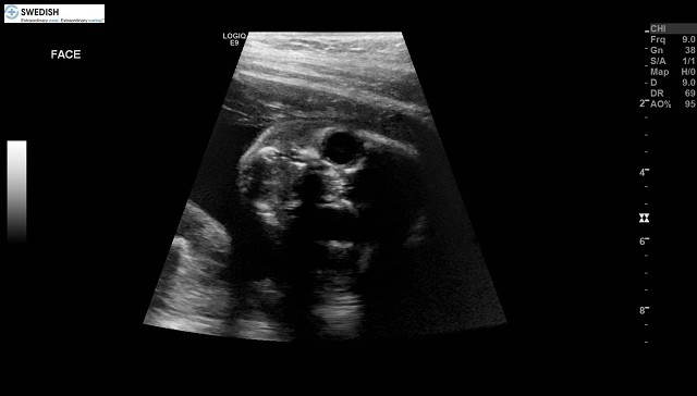 1.2.840.113619.2.256.50124668568.1570134556.841