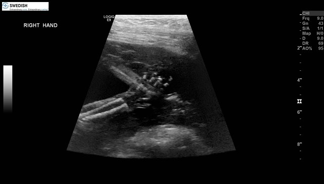 1.2.840.113619.2.256.50124668568.1570134653.1513