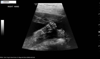 1.2.840.113619.2.256.50124668568.1570134659.1658.mp4