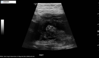 1.2.840.113619.2.256.50124668568.1570135503.2116.mp4