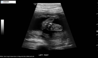 1.2.840.113619.2.256.50124668568.1570135541.2411.mp4