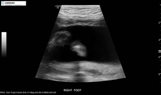 1.2.840.113619.2.256.50124668568.1570135549.2412.mp4