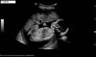 1.2.840.113619.2.256.50124668568.1570136152.6066.mp4