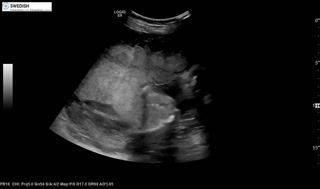 1.2.840.113619.2.256.50124668568.1570136175.6312.mp4