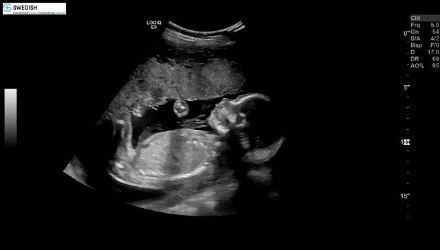 1.2.840.113619.2.256.50124668568.1570136195.6438