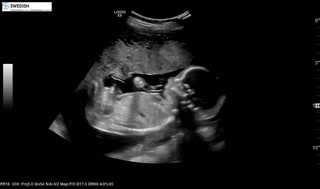 1.2.840.113619.2.256.50124668568.1570136207.6439.mp4